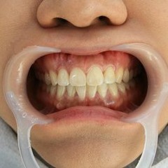 dogtooth_big_picture