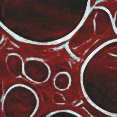 Affected Productions