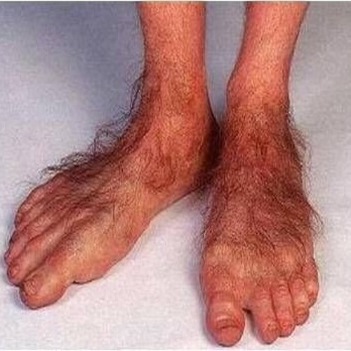 Pictures manky feet Have I