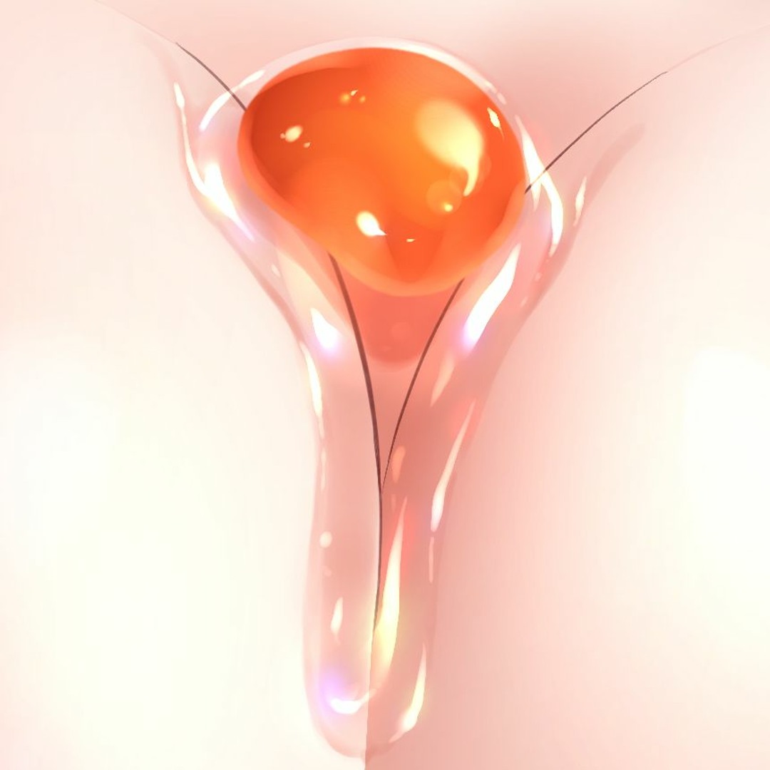 avatars-000598332999-12w2gt-