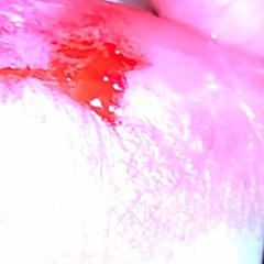 pocarii