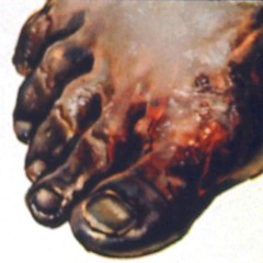Swollen Gargantuan Fecal Fetus