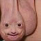 left nut