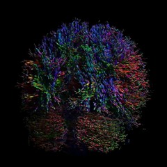 Machine Unlearning