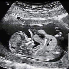 Saint Agnes  Move Like A Ghost Concurso De Mezcla LEWITT