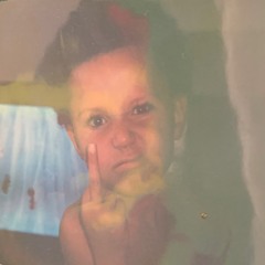 MOSES(AKA Mungo Baby)