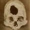 The slowest trepanator