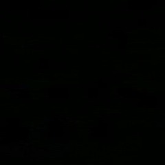 MR