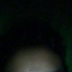 RS bonyes