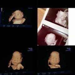 Jakaiya Mckinley