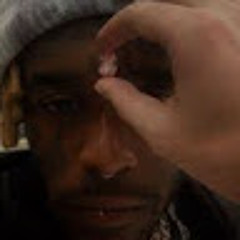 Lil Uzi Verts implant