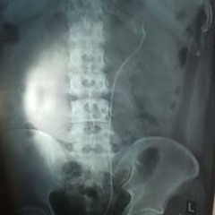 Ida Bagus Sucipta Subali
