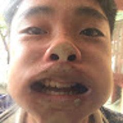 Nong Khoa