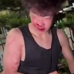 안면줘뿔라