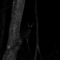 surgeonfaint