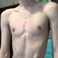 lol1375613059781359718