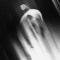 outburst