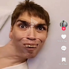 Ermal Werewolf