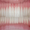 ptomaine