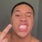 Thraxo