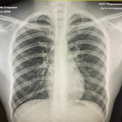 tripinsvlt | #twinklesquad