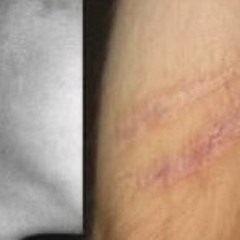 wrist