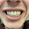 NoahCasey1125