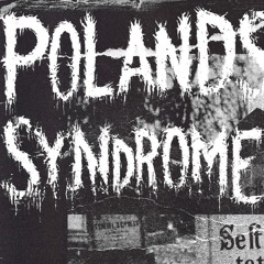 Polands Syndrome