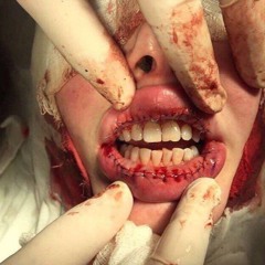 nosex
