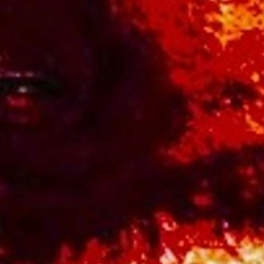 Botched Circumcision