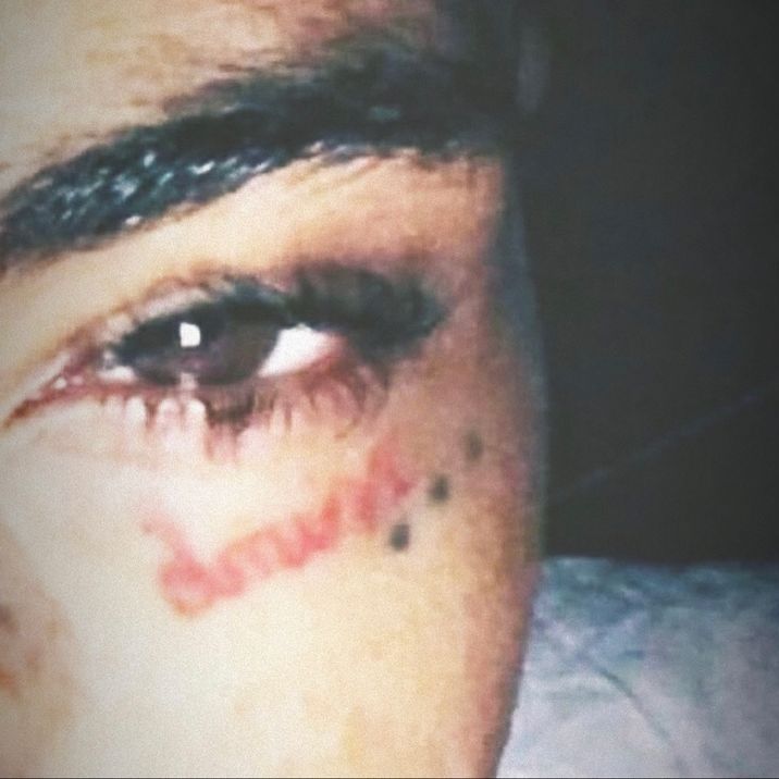 XXXTENTATION