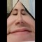 kacput