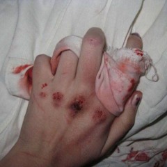 @МоиРукиВКрови