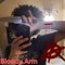 Bloody Arm