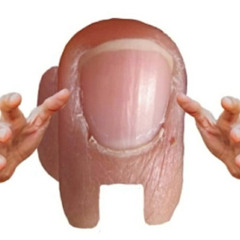 HandSUS