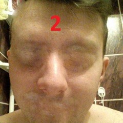 Lachimek Here 2