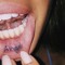 1MLILR0ME0