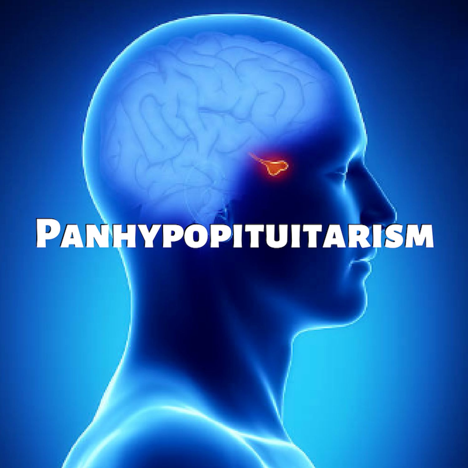 Panhypopituitarism Stories podcast artwork