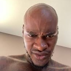 Ugliestlightskin