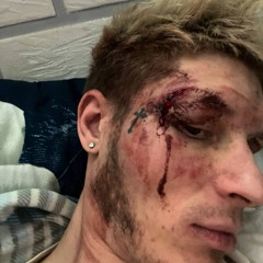 нелегал финик