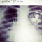 hematopoietic