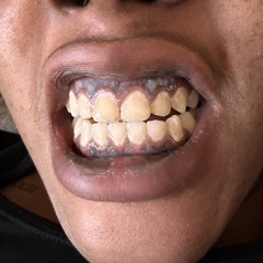 uglyamberthesuperstar