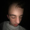 milvo