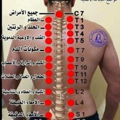 عثمان الجابر للحجامه