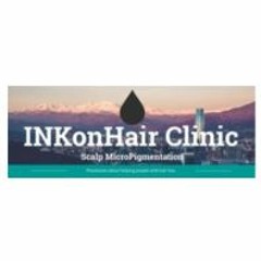 Best Scalp MicroPigmentation Clinic In UK - INKonHair Clinic