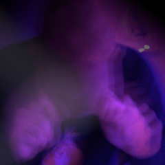 DVID