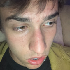 GENERAL FT. BLIZEY