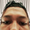 Focussan_