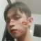 ELAK