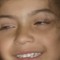 cheese